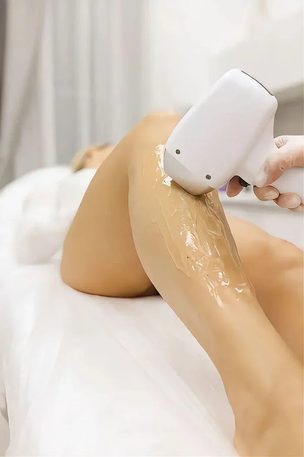 EPILAZIONE LASER PROGRESSIVA